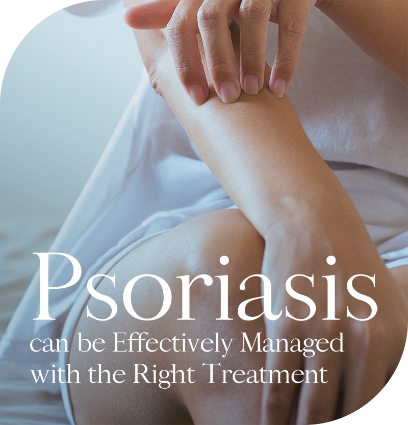 Psoriasis