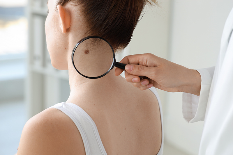 A woman receiving a medical dermatology consult.